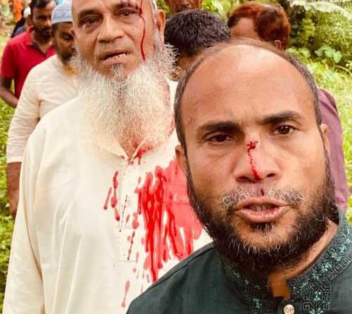 বন্দরে একই পরিবারের ৩জনকে পিটিয়ে  রক্তাক্ত, আসামীরা ২দিনেও অধরা