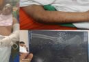 মৃত ভেবে ড্রেনের পাশে ফেলে রাখা হয়েছিল আমাকে” জুলাই আন্দোলনে গুলিবিদ্ধ বাগেরহাটের সন্তান আমিনুল ইসলামের বেঁচে ফেরার গল্প মৃত ভেবে ড্রেনের পাশে ফেলে রাখা হয়েছিল আমাকে” জুলাই আন্দোলনে গুলিবিদ্ধ বাগেরহাটের সন্তান আমিনুল ইসলামের বেঁচে ফেরার গল্প