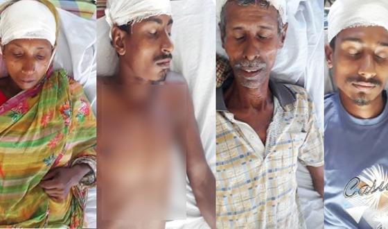 বাগেরহাটে পৈতৃক জমির বিরোধে দুই ভাইয়ের পরিবারের সংঘর্ষ, আহত ৭ চিতলমারীতে নারীসহ উভয় পক্ষের আহত; পুলিশের হস্তক্ষেপে পরিস্থিতি নিয়ন্ত্রণে