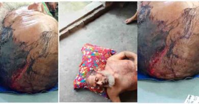 বটিয়াঘাটায় বসতবাড়িতে হামলা, স্বামী-ছেলেকে কুপিয়ে জখমের অভিযোগ; ৯৯৯-এ ফোন পেয়ে উদ্ধার