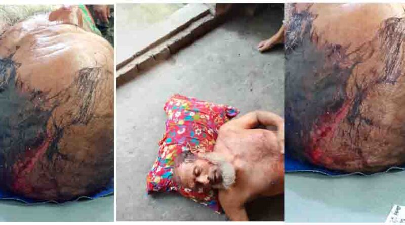 বটিয়াঘাটায় বসতবাড়িতে হামলা, স্বামী-ছেলেকে কুপিয়ে জখমের অভিযোগ; ৯৯৯-এ ফোন পেয়ে উদ্ধার